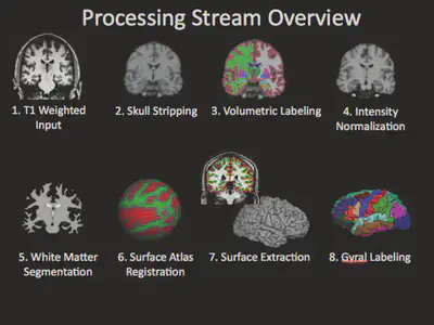 FreeSurfer pipeline